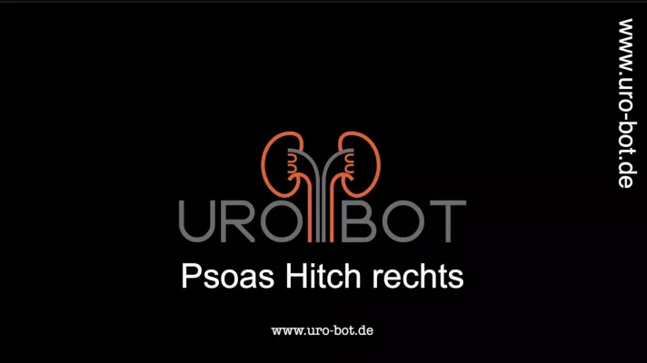 daVinci Video Psoas-Hitch - Uro-Bot.de